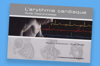 L'arythmie cardiaque : guide d'apprentissage